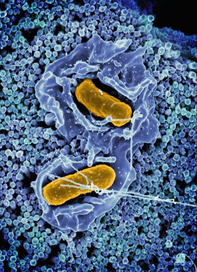 national-institute-of-allergy-and-infectious-diseases-zna7XRjnc6k-unsplash